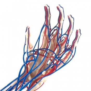 Vascular Arm